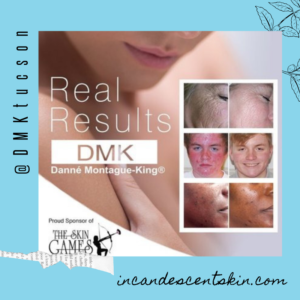 5 ways to transition sensitive skin to normal skin. DMK Results, before and afters, results driven skin care.  DMK, Clinical Brand that makes a difference. 