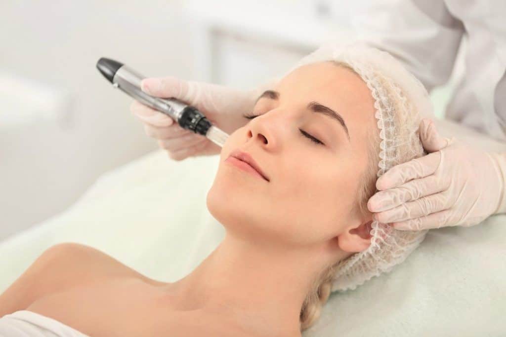 incandescent skin, microneedling, best microneedling, best tucson facial