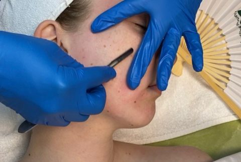 Dermaplaning to regenerate and rejuvenate skin once per month