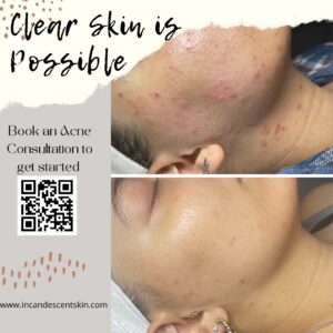 Skin Revision Treatments